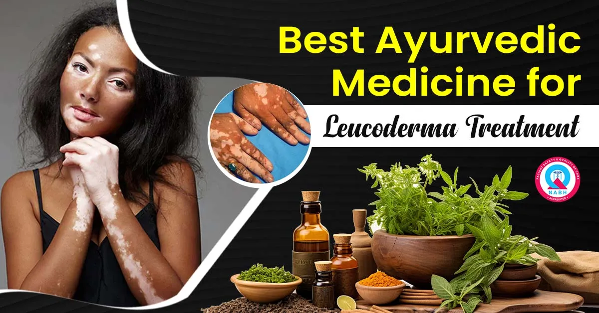 best-ayurvedic-medicine-for-leucoderma-treatment